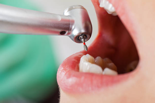 Best Emergency Denture Repair in Lake Ketchum, WA